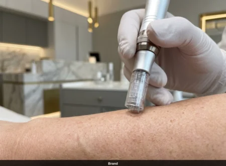 Dermapen Anwendung zur Hauterneuerung in einer Wiener Schönheitsklinik.