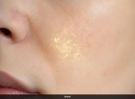 Nahaufnahme einer Wange zur Veranschaulichung der Porenverfeinerung im Gesicht nach Microneedling.