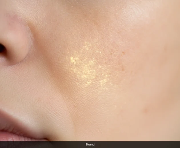 Nahaufnahme einer Wange zur Veranschaulichung der Porenverfeinerung im Gesicht nach Microneedling.