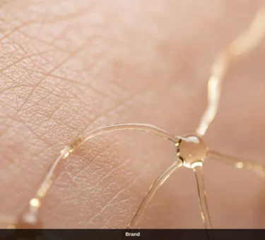 Nahaufnahme der Haut zur Veranschaulichung der Kollagensynthese nach Microneedling.