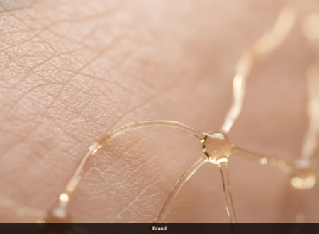 Nahaufnahme der Haut zur Veranschaulichung der Kollagensynthese nach Microneedling.