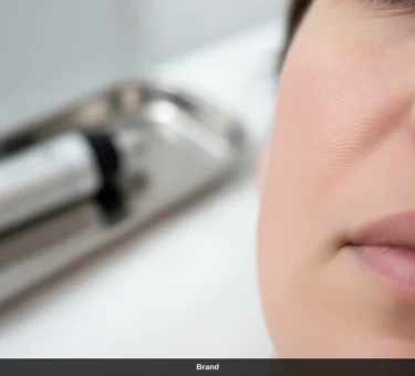 Nahaufnahme einer Hautpartie nach einer professionellen Microneedling Behandlung zur Hautregeneration.