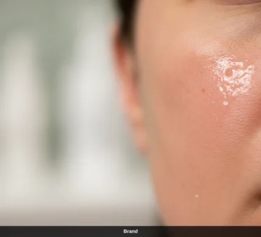 Nahaufnahme einer geröteten Wange nach dem Microneedling zur Hautregeneration.