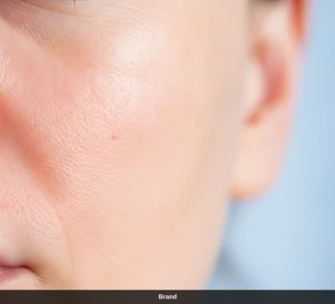 Nahaufnahme einer Hautpartie nach Mikroverletzungen durch Microneedling zur Hautregeneration.