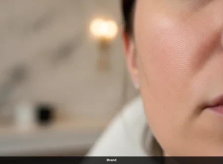 Nahaufnahme einer Wange nach dem Microneedling in Wien zur Porenverfeinerung.
