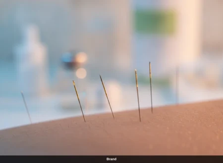 Poren verfeinern mit Nadeln: Microneedling Wirkung für ein glattes Hautbild.