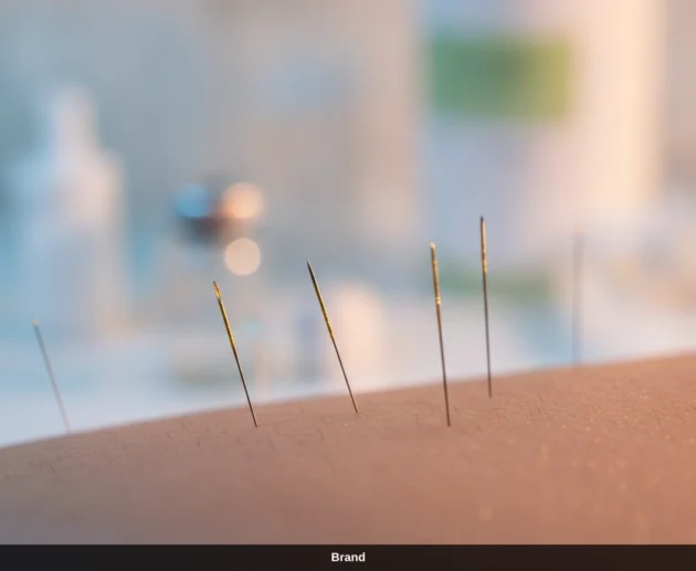 Poren verfeinern mit Nadeln: Microneedling Wirkung für ein glattes Hautbild.