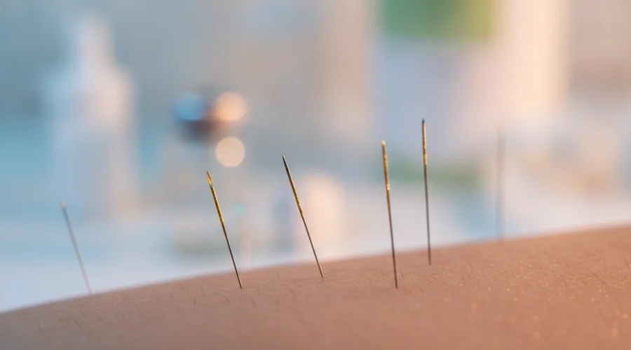 Poren verfeinern mit Nadeln: Microneedling Wirkung für ein glattes Hautbild.